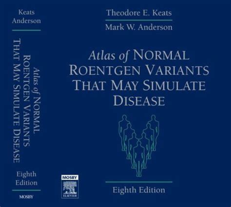 atlas of normal roentgen variants that may simulate disease 8e Reader