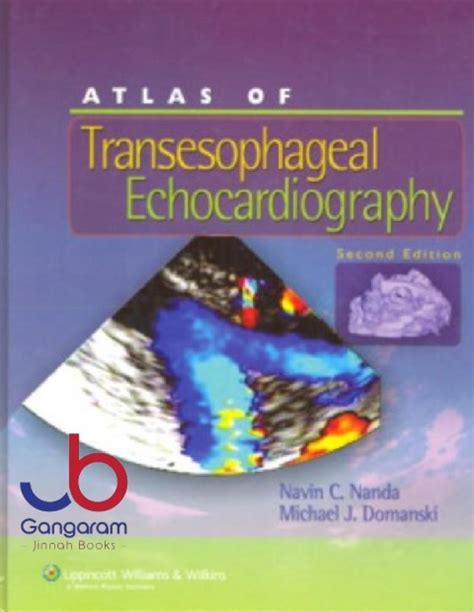 atlas of transesophageal echocardiography Doc