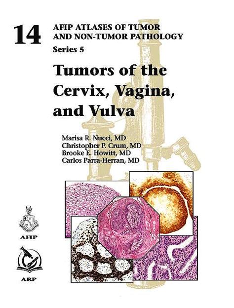 atlas of tumor pathology tumors of the cervix vagina and the vulva Epub