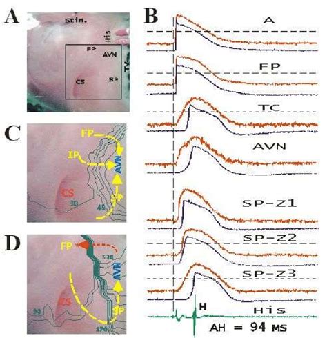 atrialav nodal electrophysiology view Doc