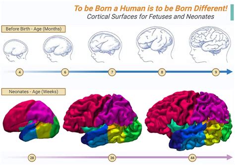 autism and the development of mind autism and the development of mind PDF