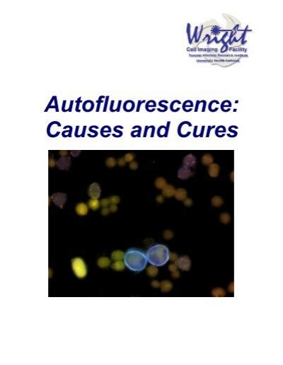 autofluorescence causes and cures PDF
