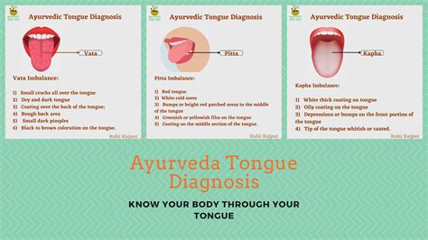 ayurvedic tongue diagnosis ayurvedic tongue diagnosis Epub