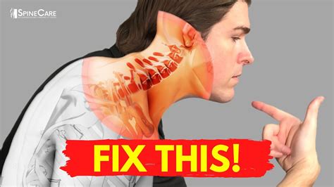 backfire the untold secrets of self treatment for neck and back pain PDF