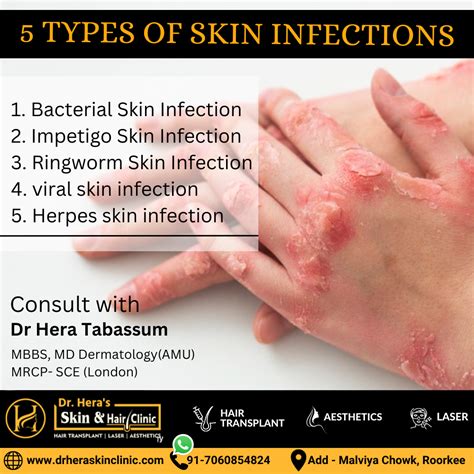 bacterial infection of the skin