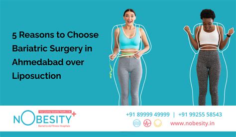 bariatric surgery in ahmedabad