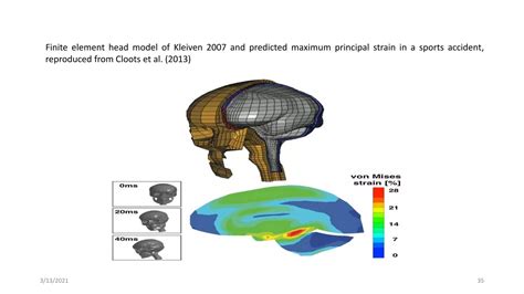 biomechanics of the brain biomechanics of the brain Doc