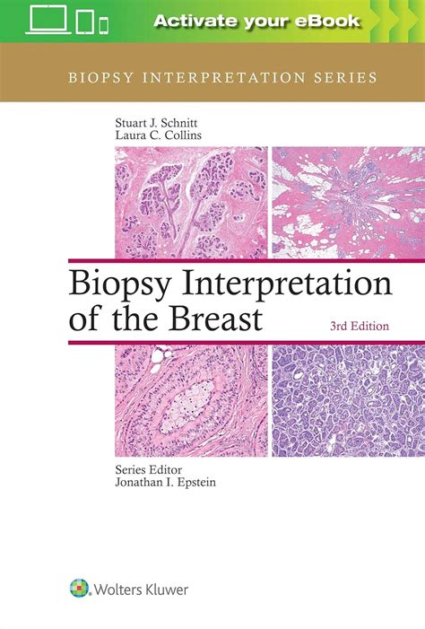 biopsy interpretation of the breast biopsy interpretation series Kindle Editon