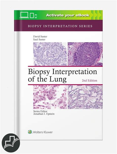 biopsy interpretation of the lung biopsy interpretation series Doc