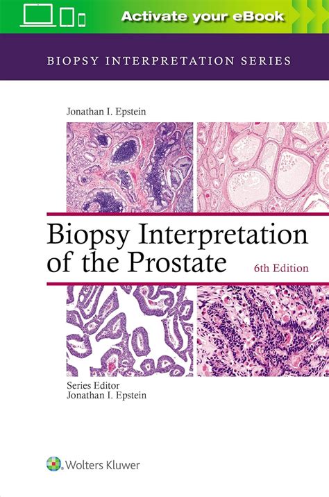 biopsy interpretation of the prostate biopsy interpretation of the prostate Reader