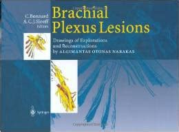 brachial plexus lesions drawings of explorations and reconstructions by algimantas otonas narakas Epub