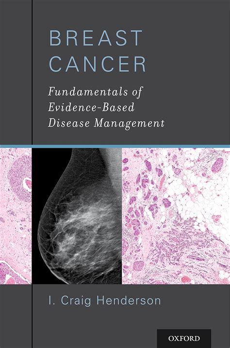 breast cancer fundamentals of evidence Kindle Editon