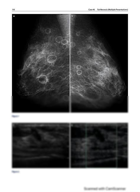 breast imaging review a quick guide to essential diagnoses Kindle Editon