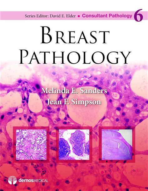 breast pathology consultant pathology Doc