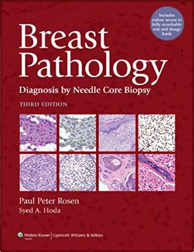 breast pathology diagnosis by needle PDF