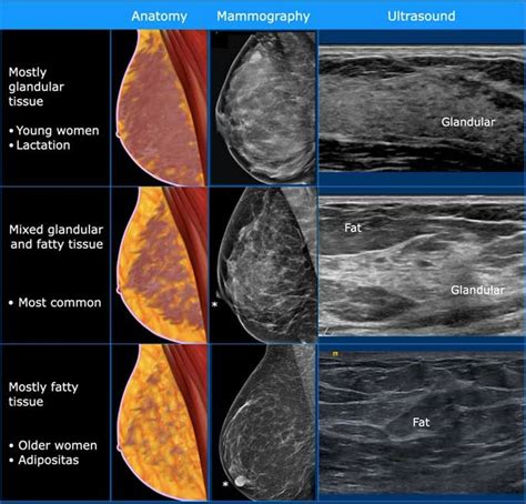 breast ultrasound how why and when 1e Kindle Editon