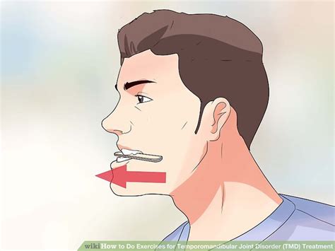 bruxism:How to Stop Grinding Teeth in Sleep Naturally