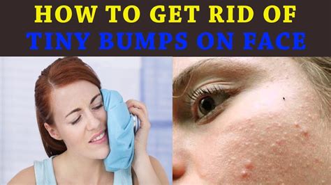 bumps on face how to remove