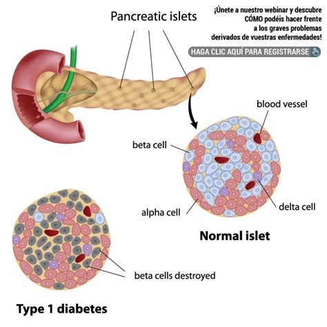 células beta pancreáticas