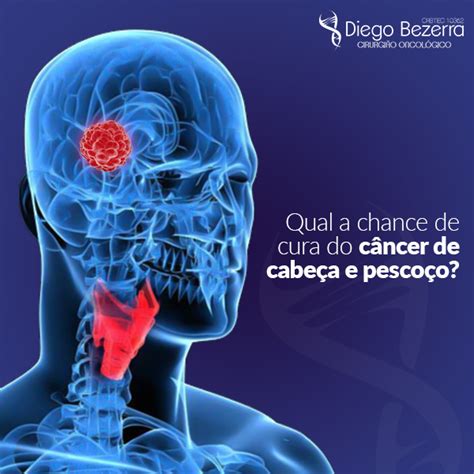 cancer da cabeça