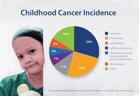 cancer in children cancer in children Epub