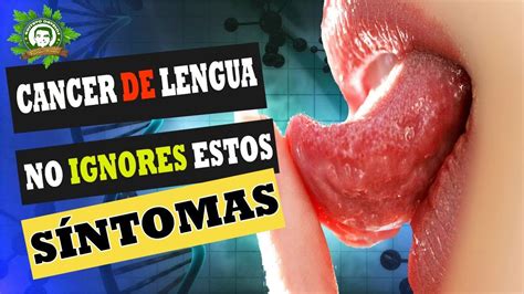 cancer lingua sintomas