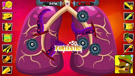 Cap N Splinters Surgeon 4 Walkthrough