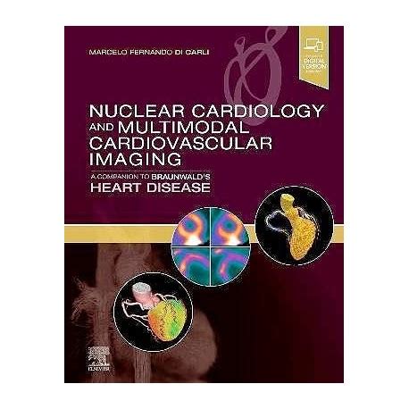 cardiac imaging a compagnion to braunwalds heart disease PDF