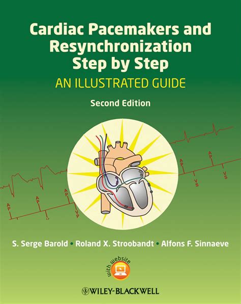 cardiac pacemakers and resynchronization step by step an illustrated guide Epub