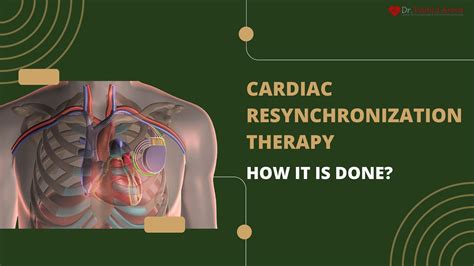 cardiac resynchronization therapy electrophysiology internal Reader