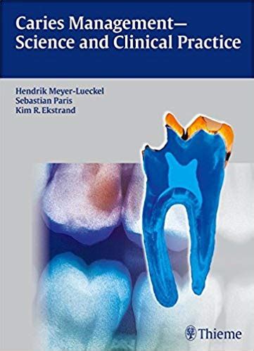 caries management science and clinical practice Ebook PDF