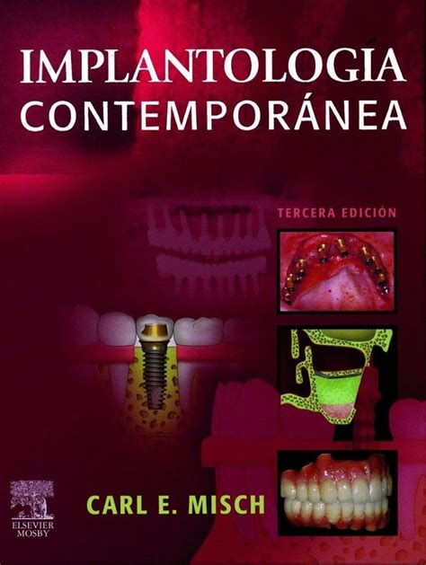 carl misch implantologia contemporanea pdf Kindle Editon
