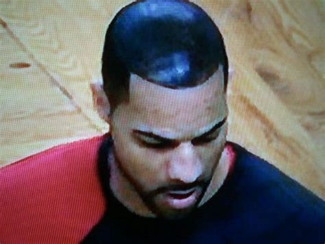 carlos boozer hairline