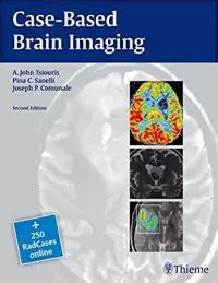 case based brain imaging radcases Doc