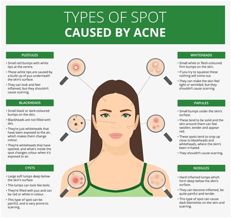 causes of pimples on face in adults