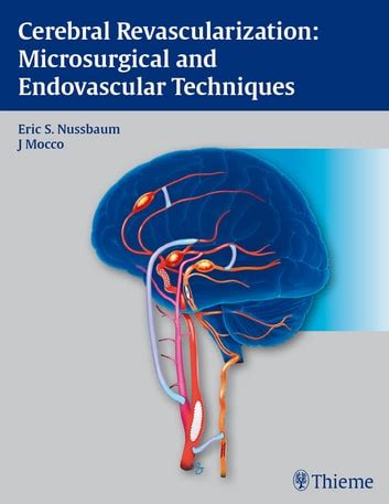 cerebral revascularization microsurgical and endovascular techniques PDF