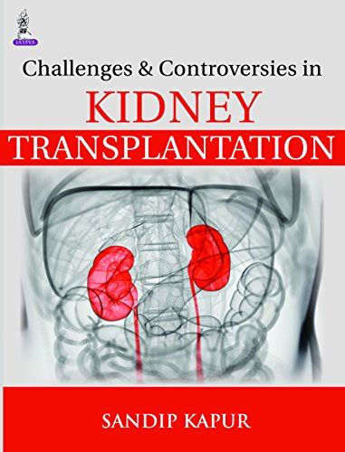 challenges-and-controversies-in-kidney-transplantation Ebook Epub