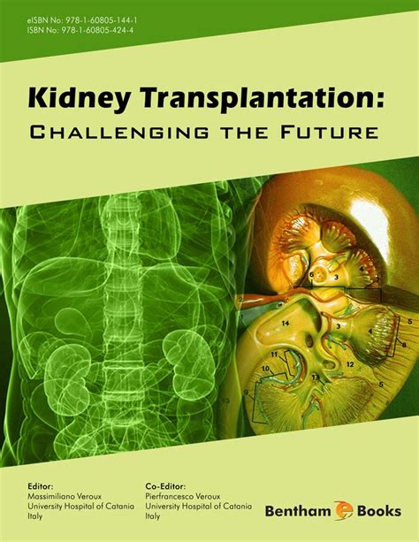 challenges-and-controversies-in-kidney-transplantation Ebook Epub