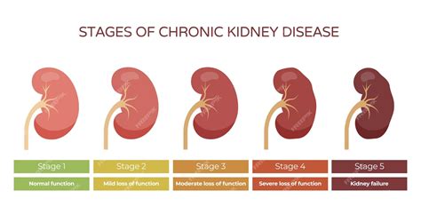 Chart Of Kidney Disease Stages