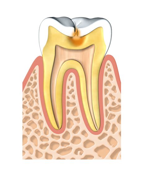 cheapest root canal treatment in singapore