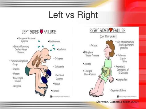 chf left vs right