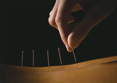 chinese medical acupuncture a brief introduction Doc