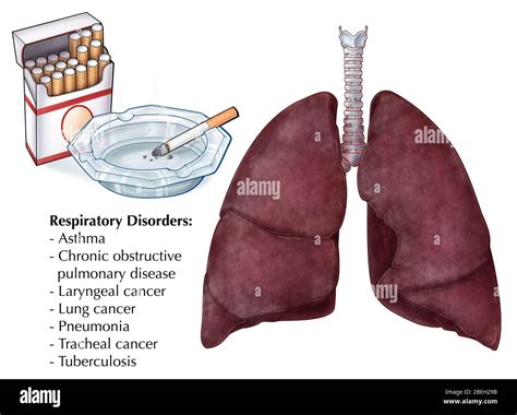 chronic lung disease in asia smoking pollution and the haze Reader