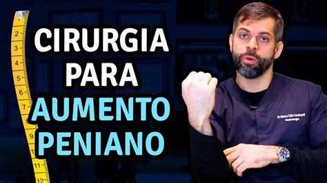 cirurgia aumento peniana