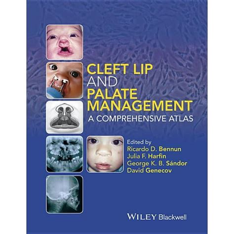 cleft lip palate management comprehensive Reader
