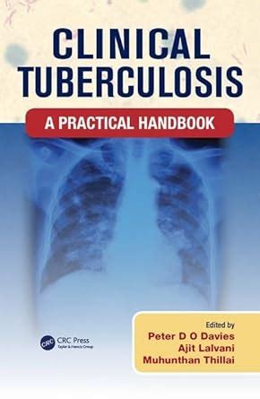 clinical tuberculosis practical peter davies Kindle Editon