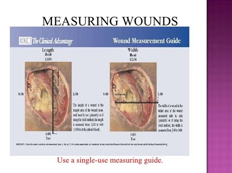 cms guidelines for wound measurements Epub