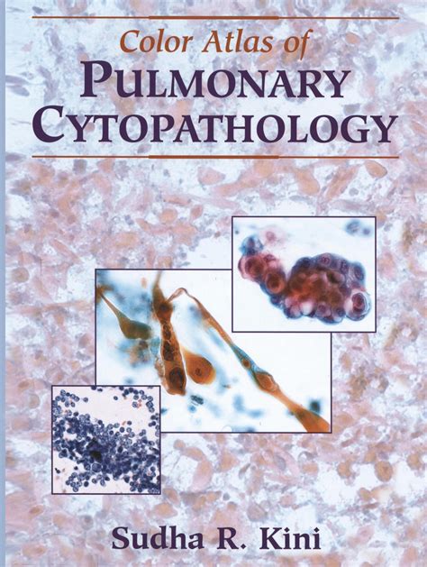 color atlas of pulmonary cytopathology Kindle Editon