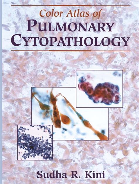 color atlas of pulmonary cytopathology Kindle Editon