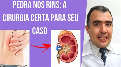 como tirar pedra no rim